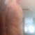 triadnudist